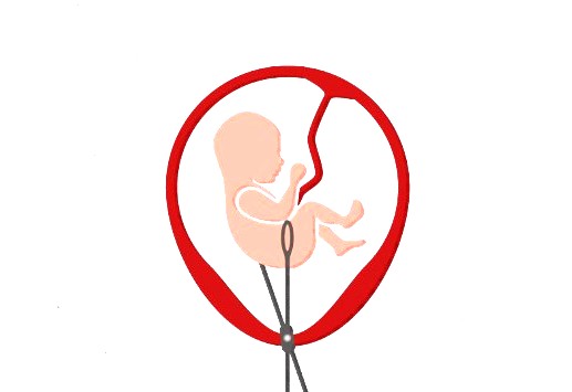 Abort_po_oms